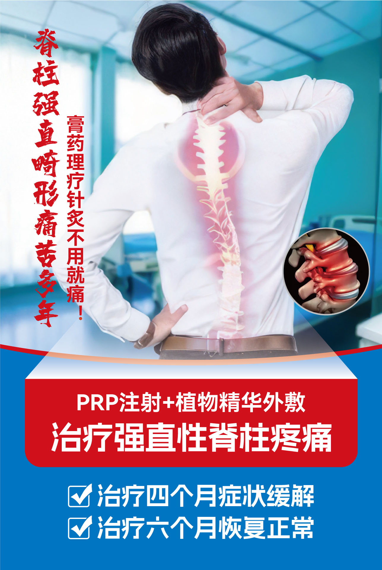脊柱炎.jpg